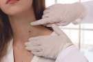 Cabines contra lesions de pell, a Roses